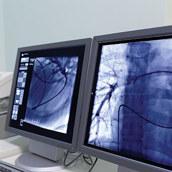 interventional radiology