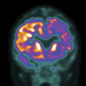 PET/CT Scan - Plant City Radiology and Imaging